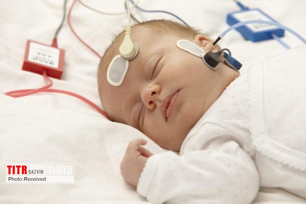 شناسایی 90 نوزاد اختلال شنوایی در قزوین